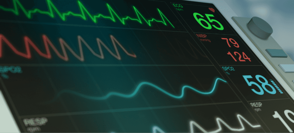 A close up shot of a piece of medical capital equipment - a vitals monitor